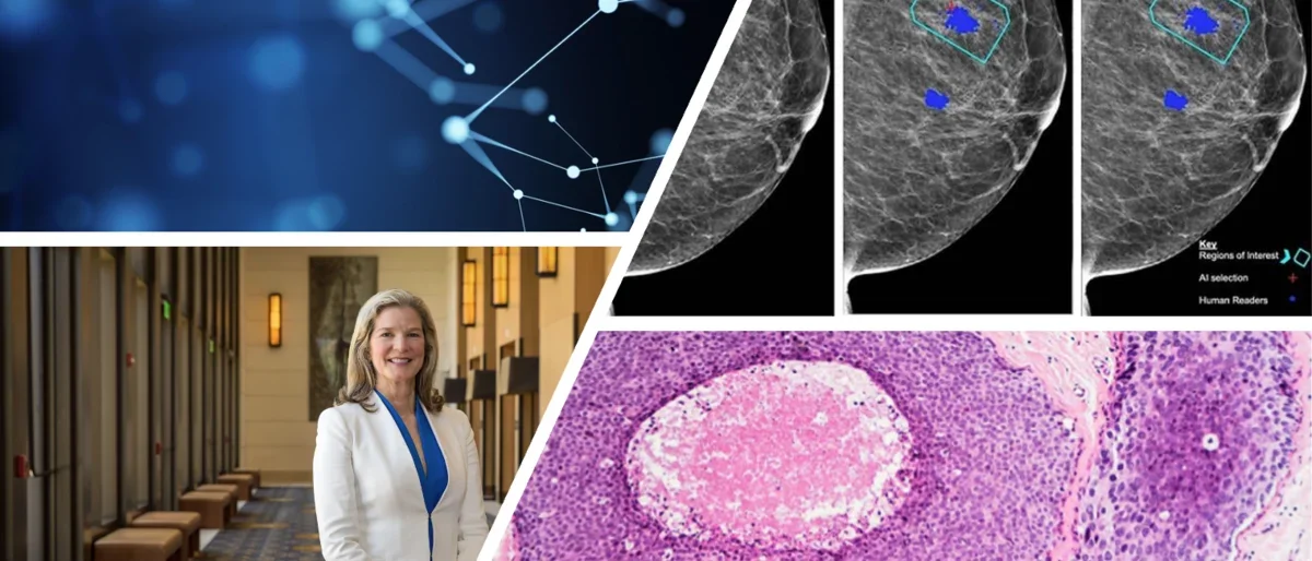 Collage of images showing a portrait of PI Dr. Joann Elmore, a breast cancer pathology slide, a mammogram with AI markings, and a neural network representing technology and AI.