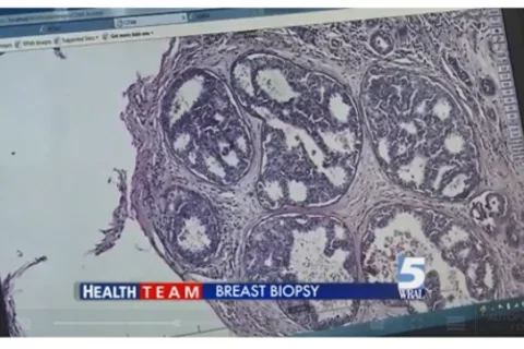 Video screen capture of a PBS News Hour video.