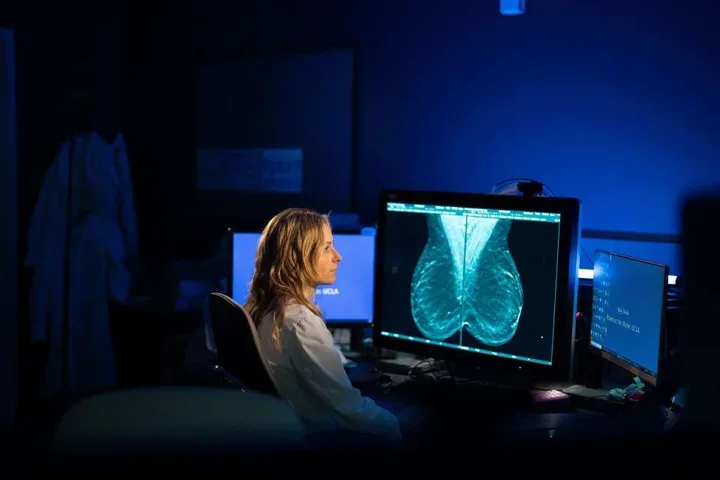 Dr. Milch reviewing a mammogram