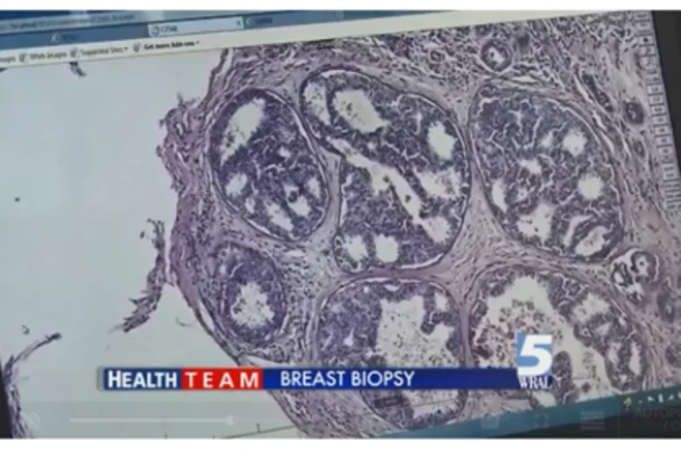 Video screen capture of a PBS News Hour video.