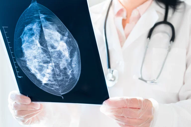 A doctor wearing a stethoscope holds and examines an X-ray slide.